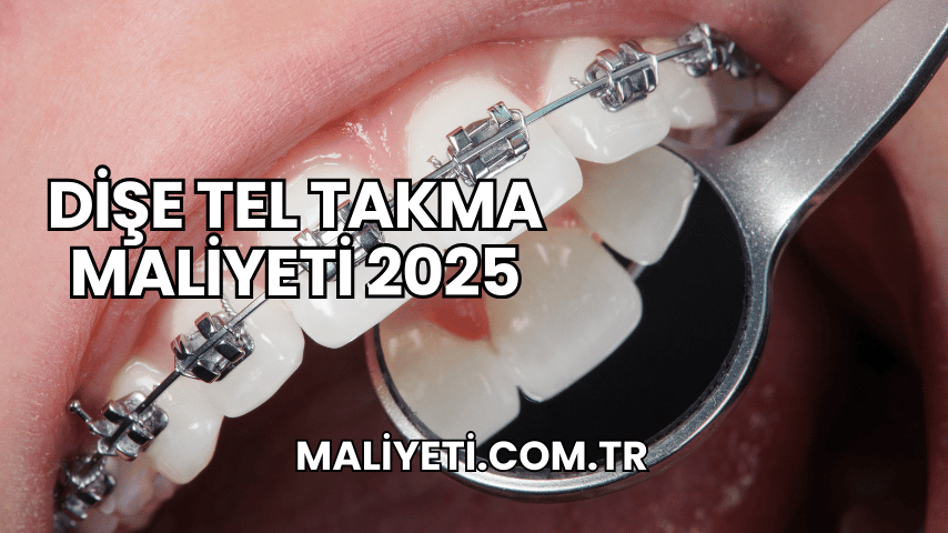 Dişe Tel Takma Maliyeti 2025